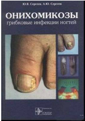 Онихомикозы. Грибковые инфекции ногтей, Сергеев Ю.В., Сергеев А.Ю. 1998 г.