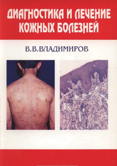 Диагностика и лечение кожных болезней, В.В.Владимиров. 1995 г.