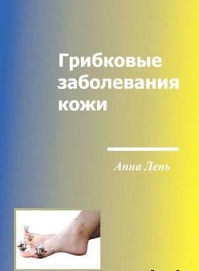 Грибковые заболевания кожи, Анна Лень. 2003 г.