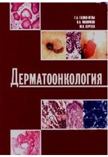Дерматоонкология, Галил-Оглы Г.А., Молочкова В.А., Сергеева Ю.В. 2005 г.